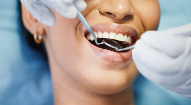 Best Emergency Treatment for Dental Infections or Abscesses in Hallam, PA