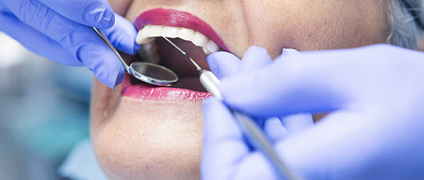 Best Urgent Care for Lost Fillings or Crowns in Hallam, PA